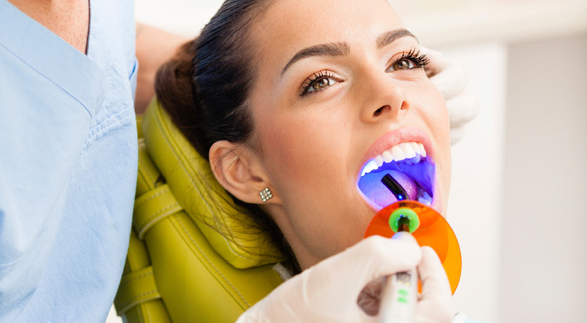 Best teeth whitening options