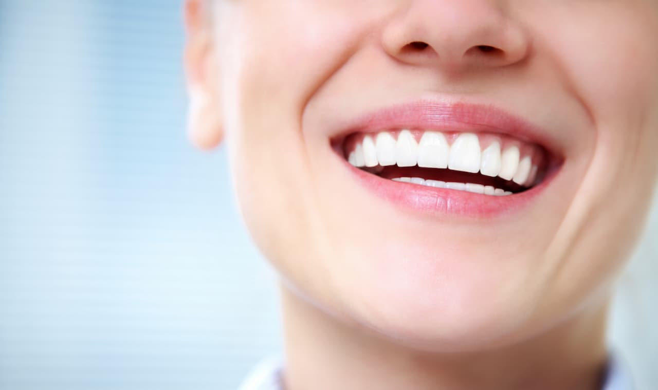 Three steps to a perfect smile!