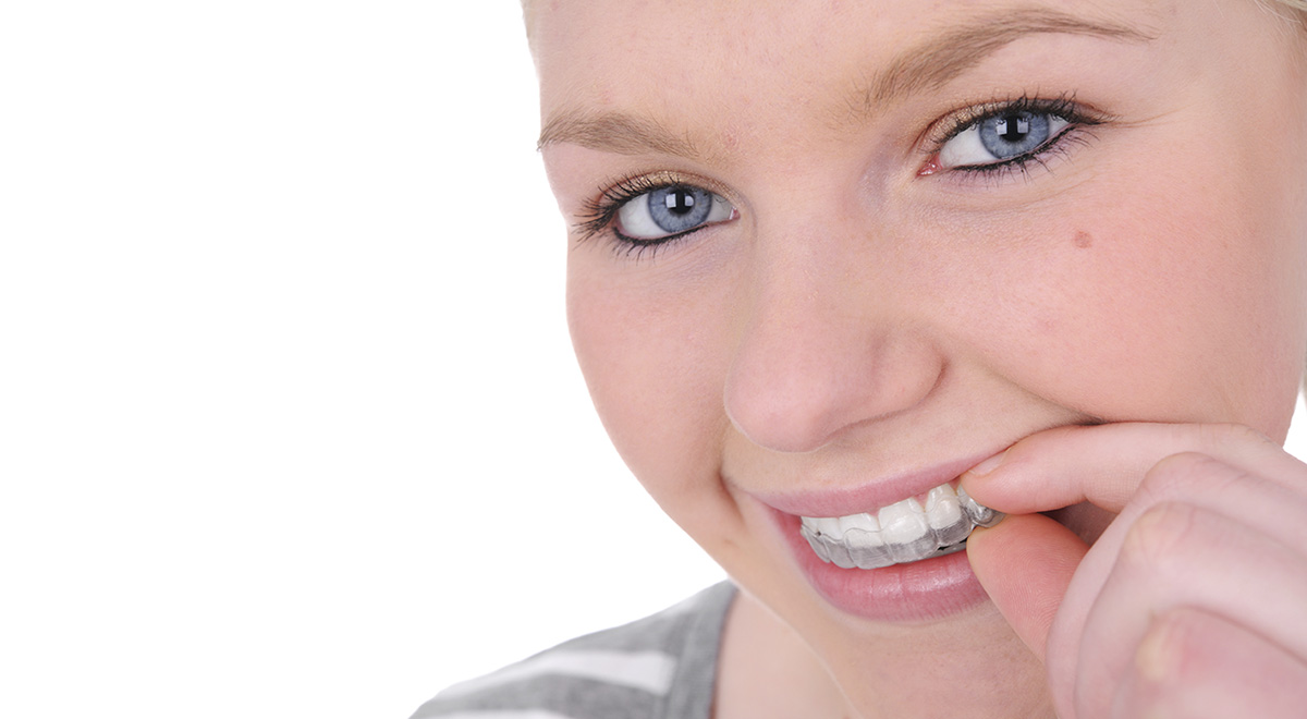 Of Invisalign Teen At 74