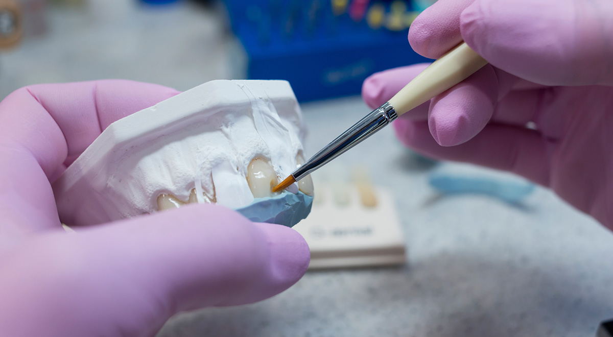 Porcelain crowns are popular because they look like your natural teeth.