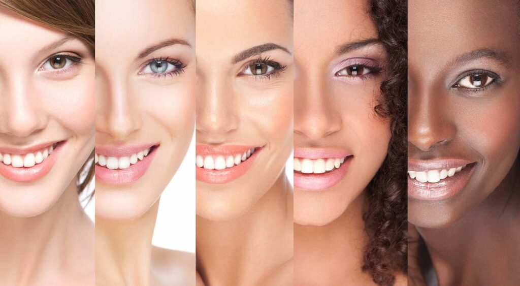 Complete Smile Makeover Examples