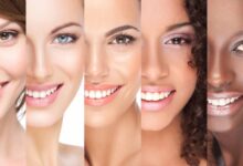 Complete Smile Makeover Examples