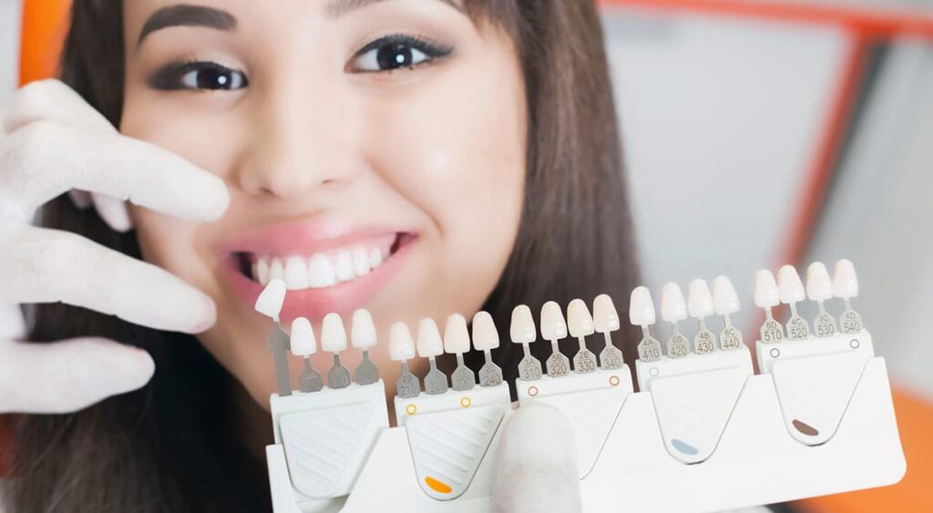 Permanent Dental Crown Samples Chart