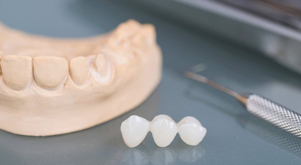 Permanent Dental Crowns Being Made