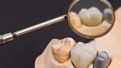Permanent Dental Crowns Samples