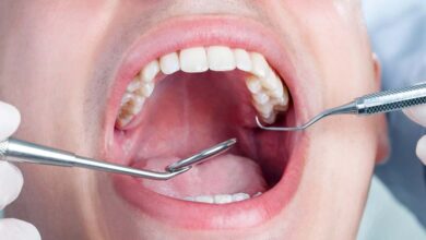 Teeth Whitening Solutions Check Up
