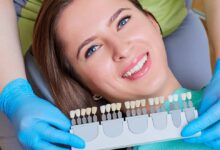 Teeth Whitening Solutions Tooth Colour Chart