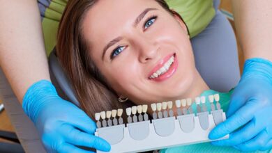 Teeth Whitening Solutions Tooth Colour Chart