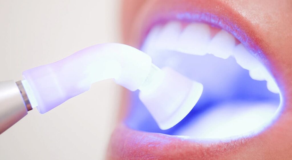 Tooth Whitening Safety Whitening Light