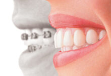 Quality-Dental-8