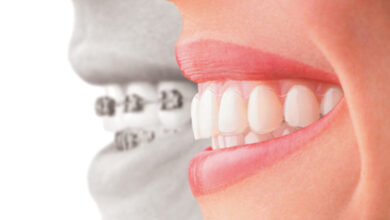 Quality-Dental-8