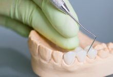 Quality-Dental-Sydney-104-Dental-implants