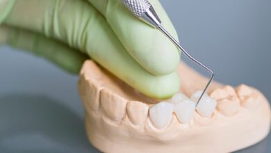 Quality-Dental-Sydney-104-Dental-implants