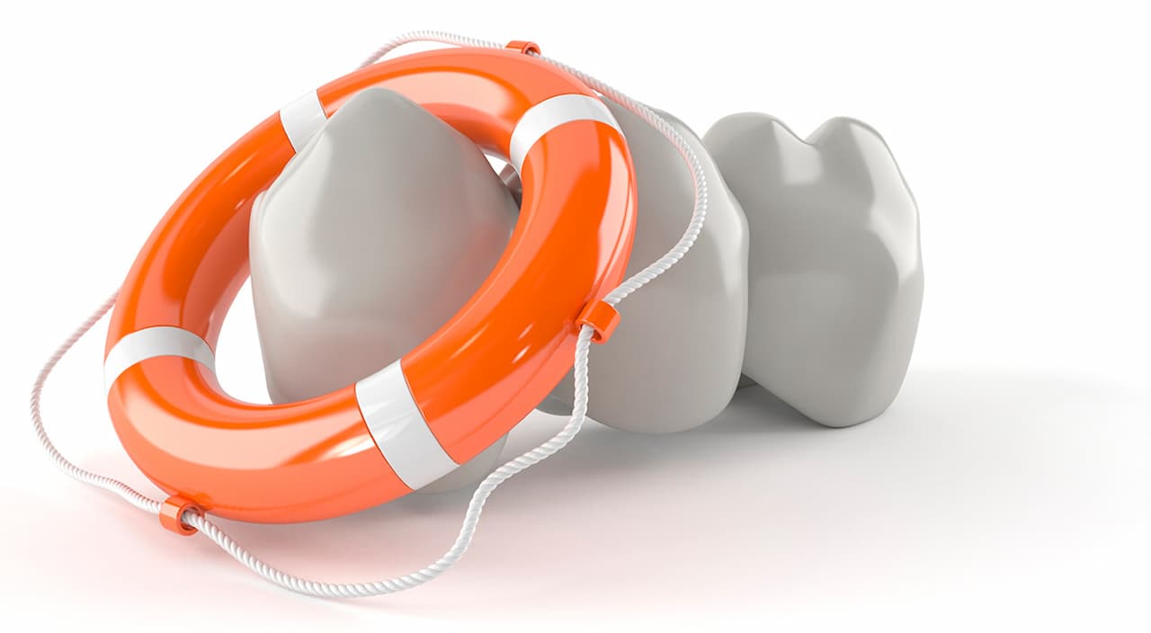 Quality-Dental-Sydney-105-Dental-implants